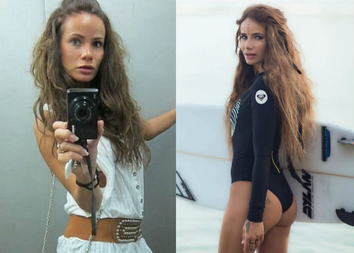 Айза Анохина до и после пластики — фото