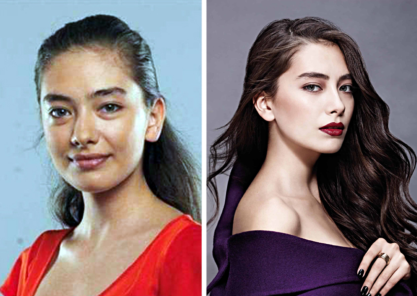 Турецкие актрисы сериалов до и после пластики: фото