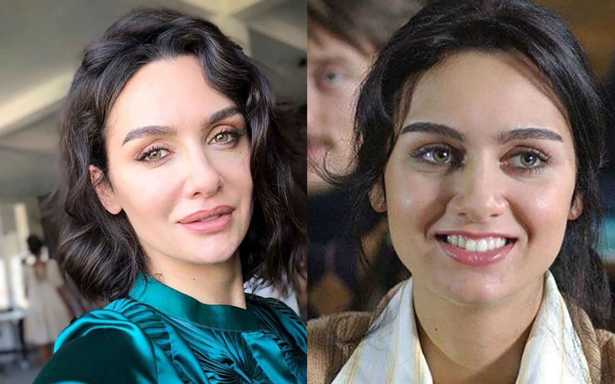Турецкие актеры сделавшие пластику лица
