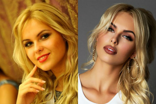 Ханна до и после пластики — фото без макияжа