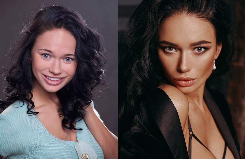 Яна Кошкина до и после пластики — фото актрисы
