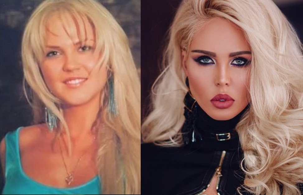 Мария Погребняк до и после пластики — фото