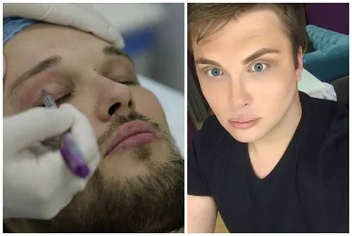 Егор Халявин до и после пластики — фото