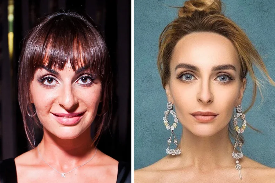 Екатерина Варнава до и после пластики — фото