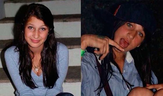 Белла Хадид до и после пластики — фото
